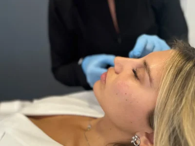 ¿Por qué el botox quita las arrugas? Todo lo que necesitas saber rápido