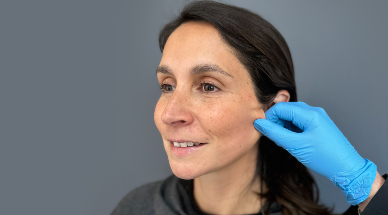 Radiesse: Innovación en rejuvenecimiento facial 1 Rádiese evaluación