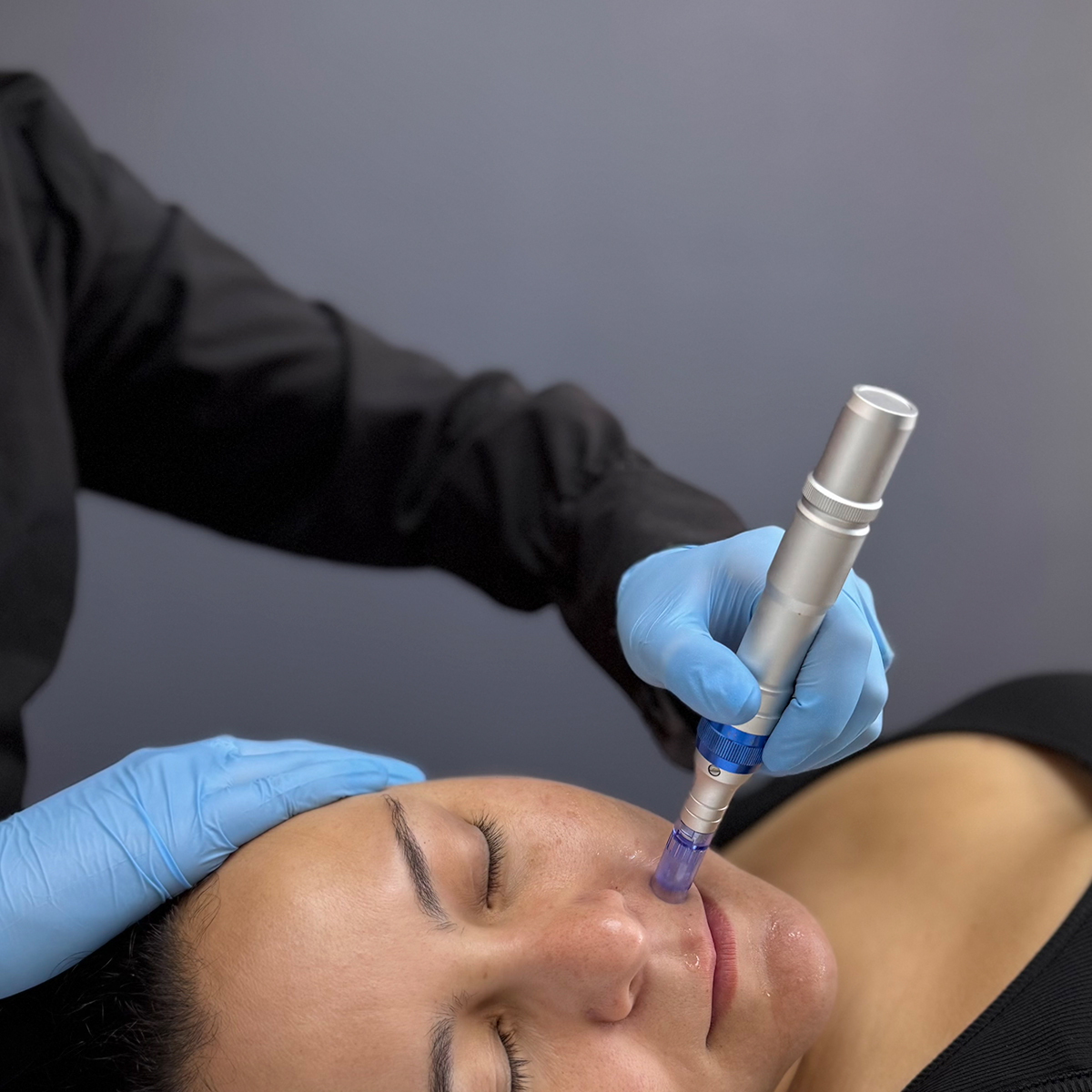 Plasma rico en plaquetas: 5 razones por las que este tratamiento biológico es seguro y efectivo