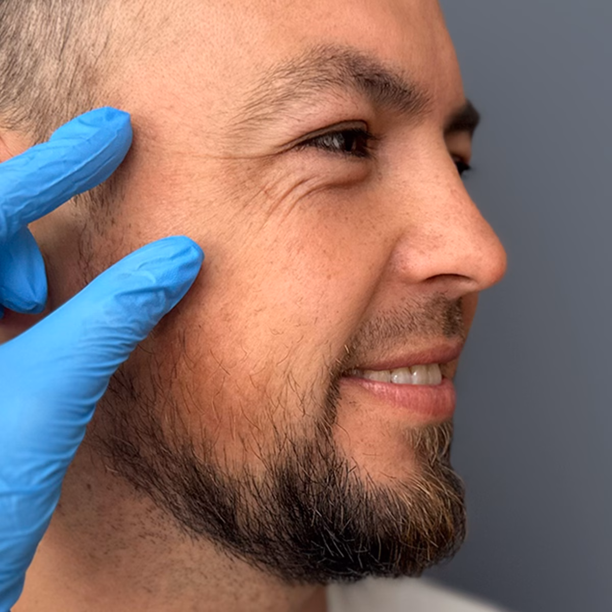 Contorno de ojos: 7 señales de envejecimiento temprano que no debes ignorar
