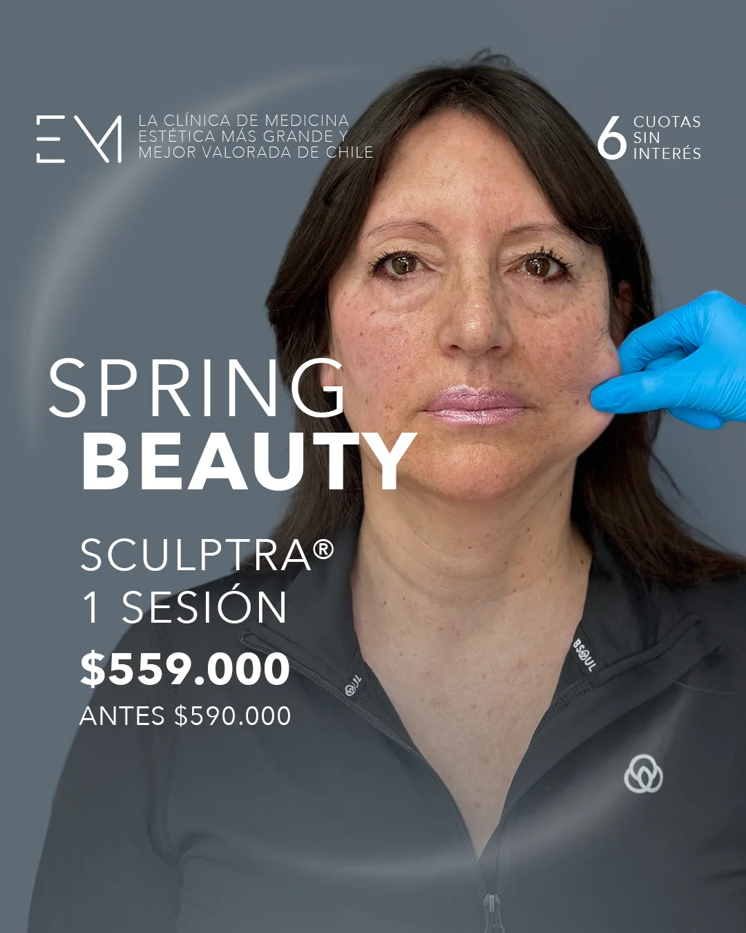 Sculptra&reg; bioestimulaci&oacute;n facial