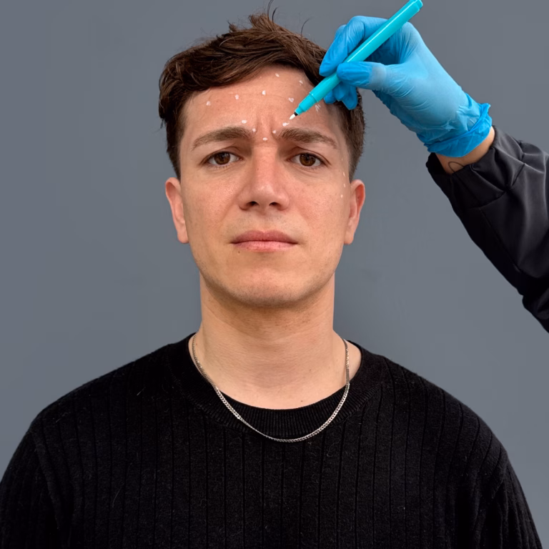 Blog Al Box 2 Por qué el bótox da dolor de cabeza y cuándo consultar al médico