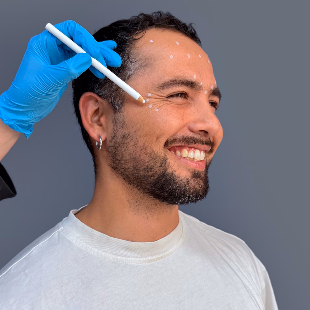 Botox cuando puedo hacer ejercicio