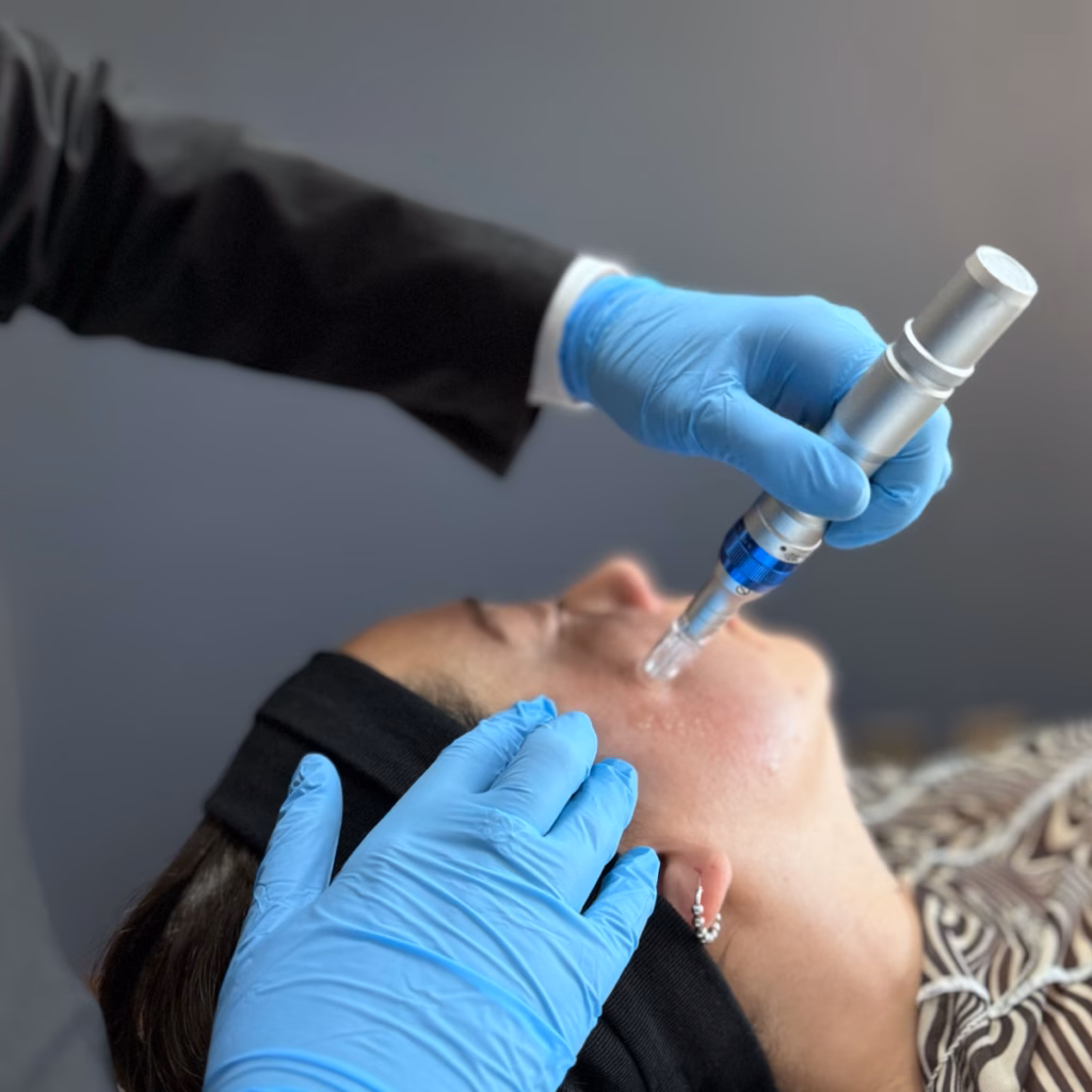 Cuánto dura la mesoterapia facial para hidratar y dar luminosidad
