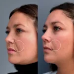 Long Lasting redensifica, hidrata y tensa la piel