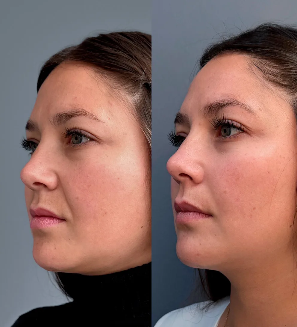 Long Lasting redensifica, hidrata y tensa la piel 2 Long Lasting redensifica, hidrata y tensa la piel