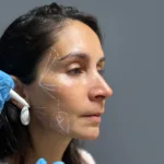 Portada AD Radiesse Botox 3z 1