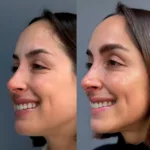 Portada AD pink glow