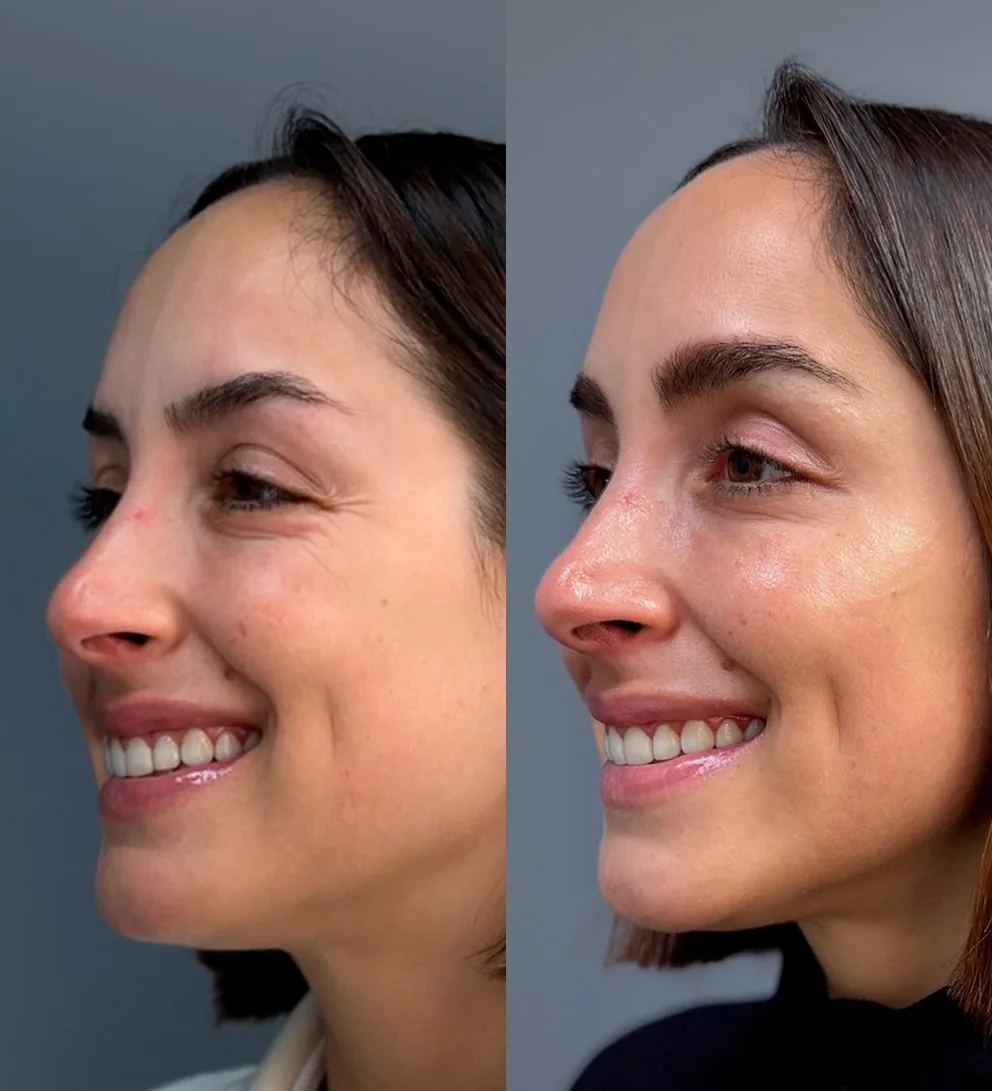 Pink Glow&reg; regeneraci&oacute;n y luminosidad Facial