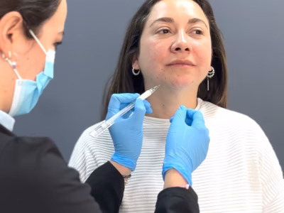 Ultradeep Teoxane: la línea que se traza con precisión