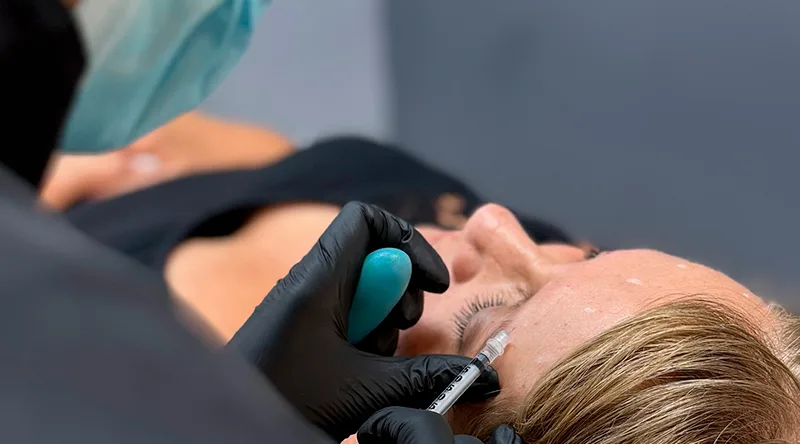 ¿Cuándo comienza el Black Friday 2025? Tratamientos estéticos en oferta que no te puedes perder 1 black friday rejuvenecimiento facial con descuento Clínica EM