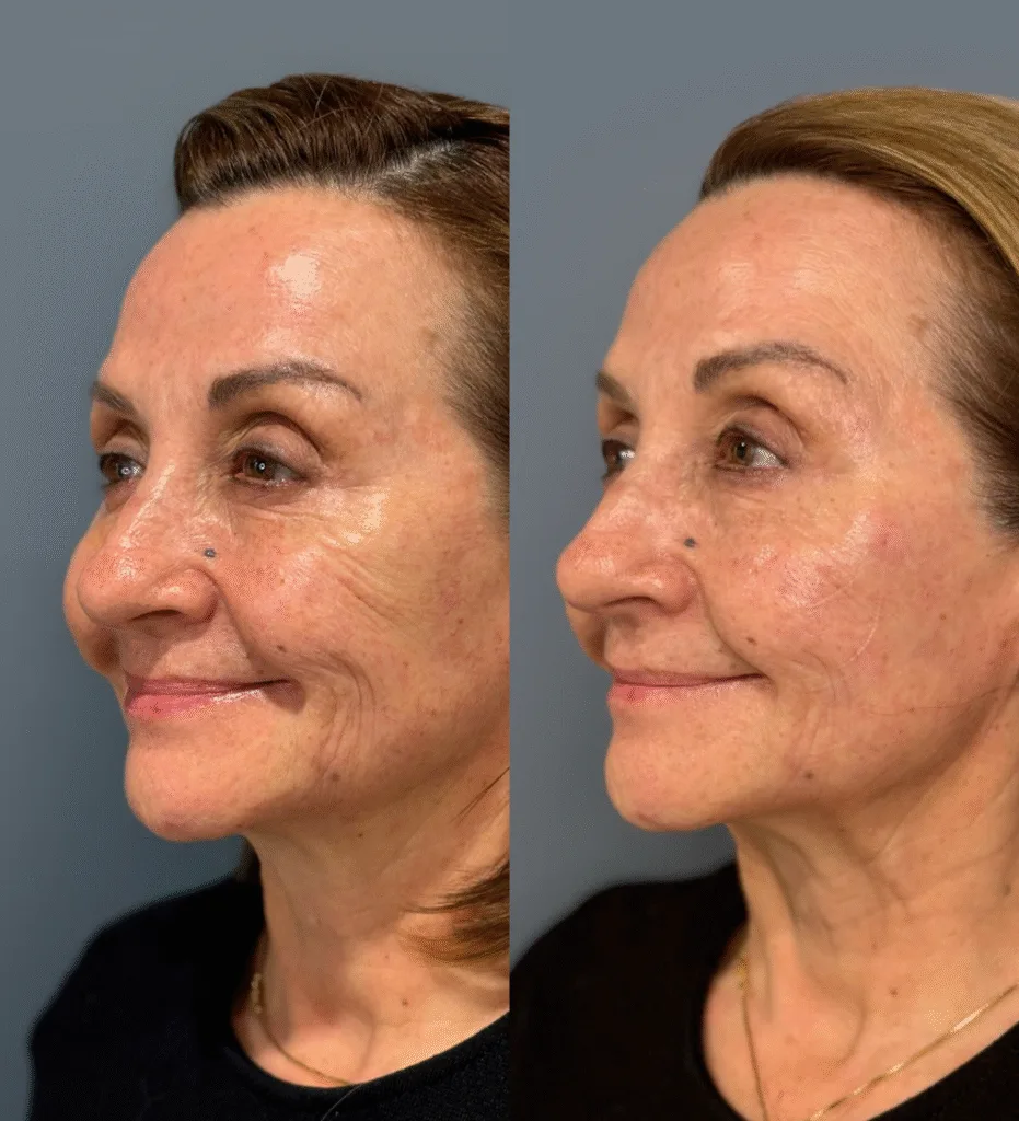 Skinvive: hidratación profunda y luminosidad sin generar volumen 1 Skinvive hidratación innovadora y piel más luminosa