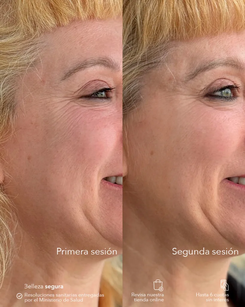 ADN de salmón: qué es y para qué sirve (guía clara y directa) 1 AD Nucleofill Strong 3sesion 01