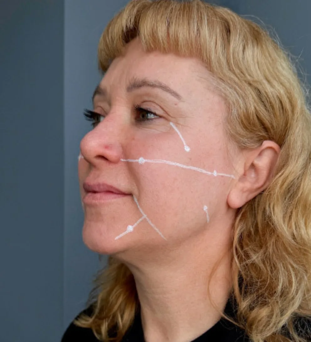 adn de salmon nucleofill strong