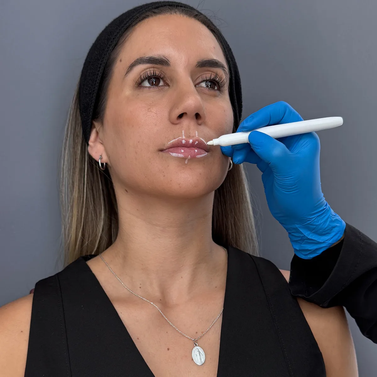 Formas de labios y técnicas innovadoras de relleno para resultados naturales