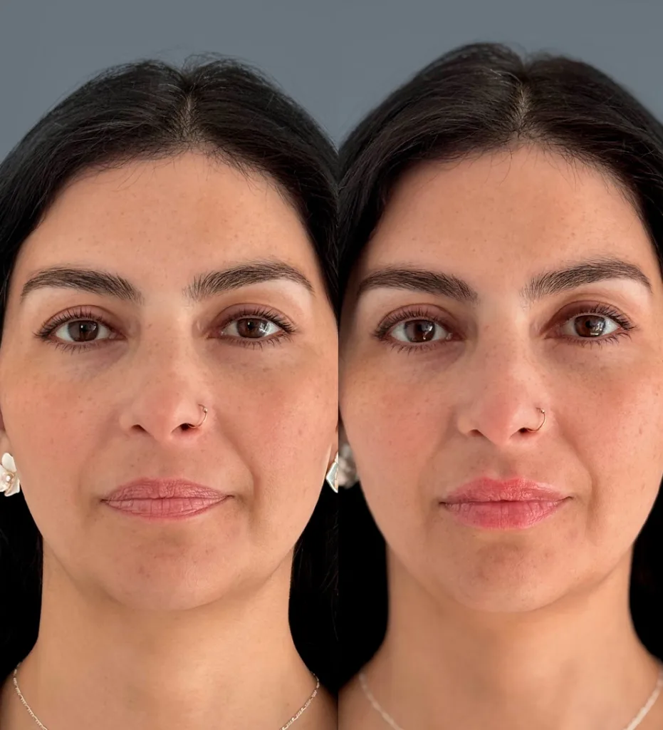 Portada AD kiss teoxane 2