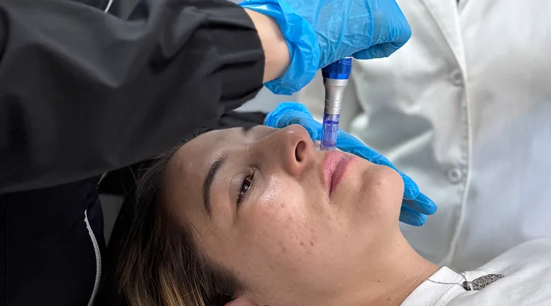 mejor cl&iacute;nica est&eacute;tica en Santiago