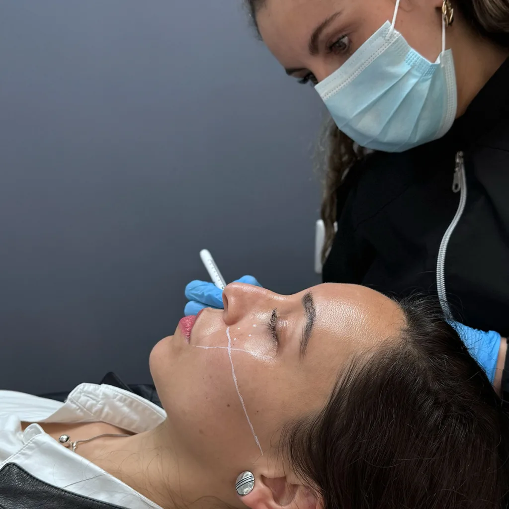 tercio medio del rostro