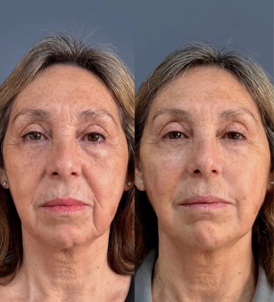 Diseno sin titulo 15