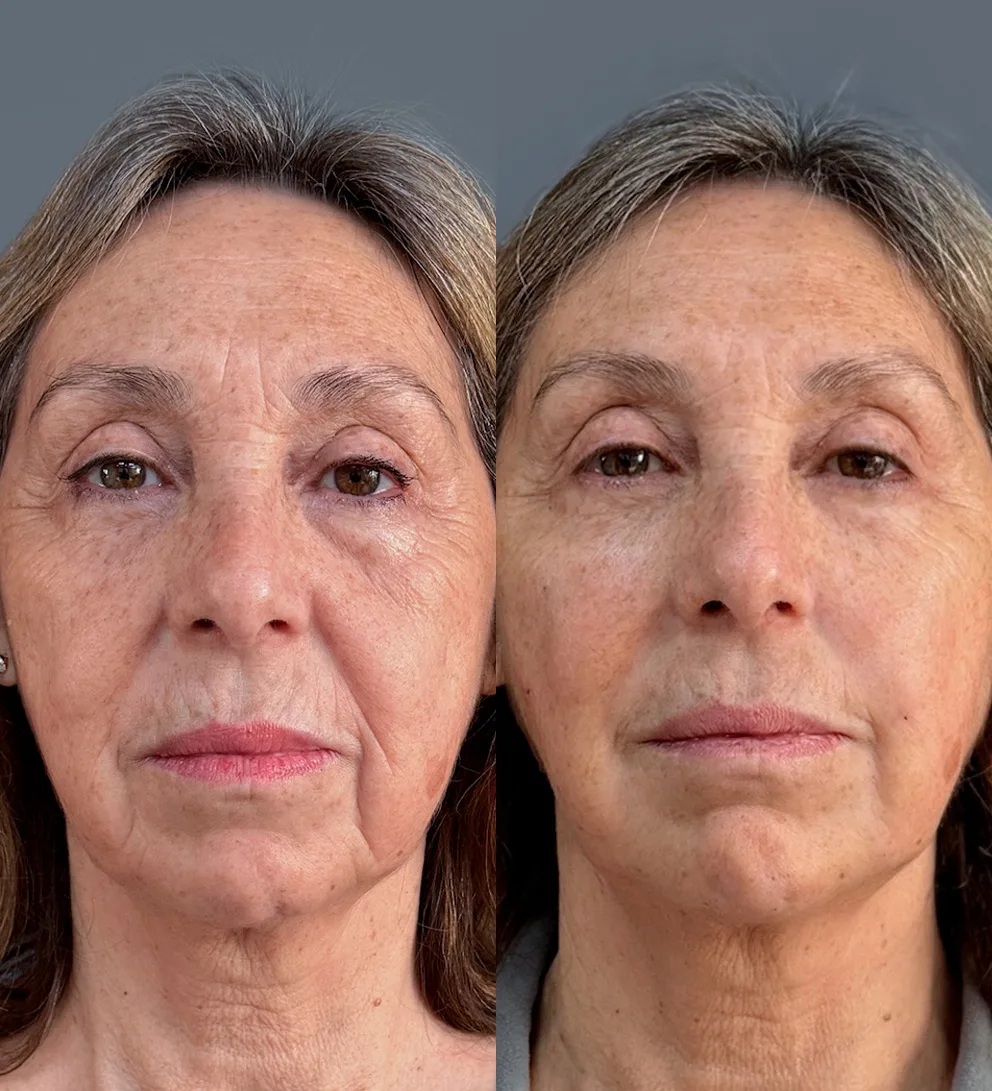 Portada AD Contenidos rellenos full