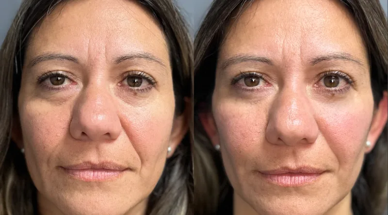 Mis p&oacute;mulos se cayeron, c&oacute;mo recuperarlos