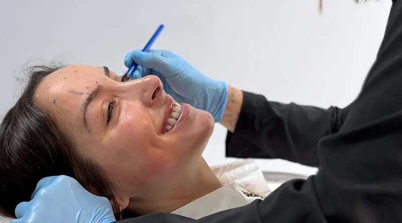 antes de aplicarte Botox