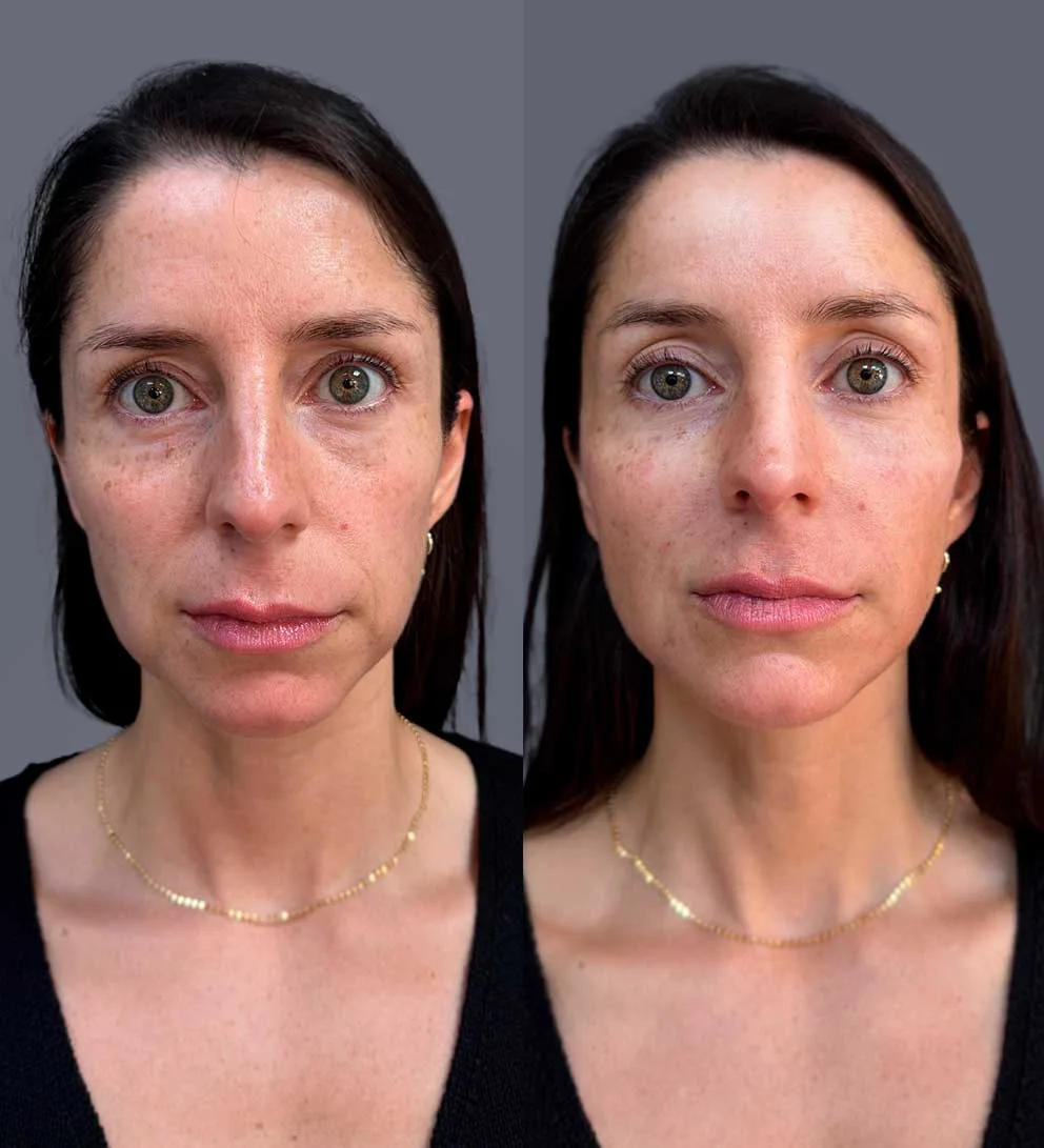 Clínica EM 30 participa por longlasting