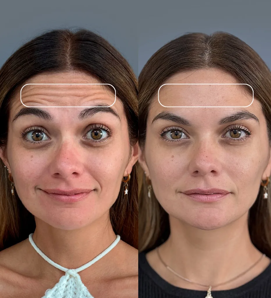 Mejor clínica estética en Chile según pacientes y estándares médicos 6 mejor clinica estetica en chile