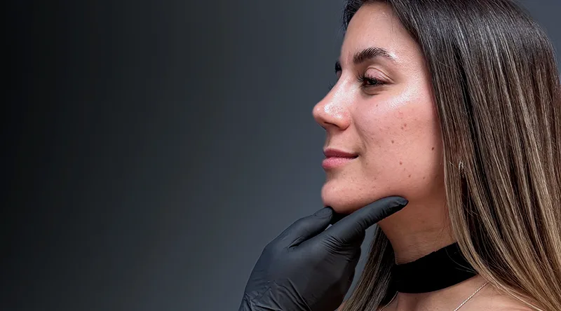 Por qué los precios de Black Friday en estética pueden variar 1 precios de Black Friday en estética