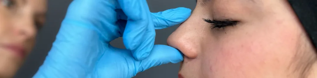 Rinomodelación en Las Condes: Perfilamiento nasal sin cirugía 1 rinomodelacion