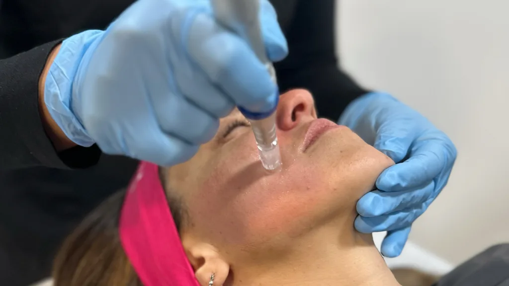 mesoterapia facial
