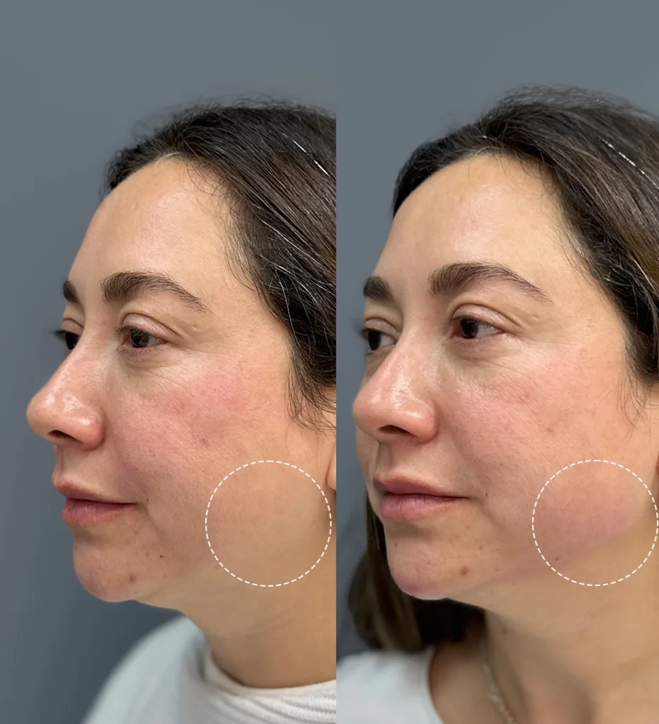 Portada AD Contorno mandibular 1