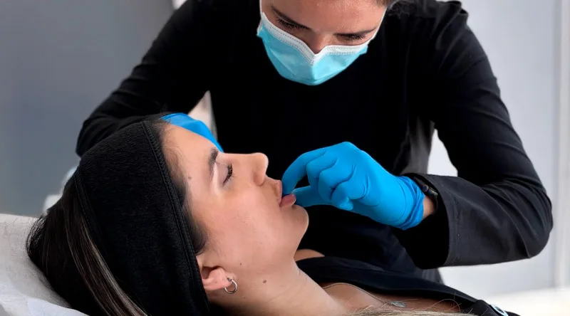 Clínica EM 1 Fotos Look week AH Labios 1