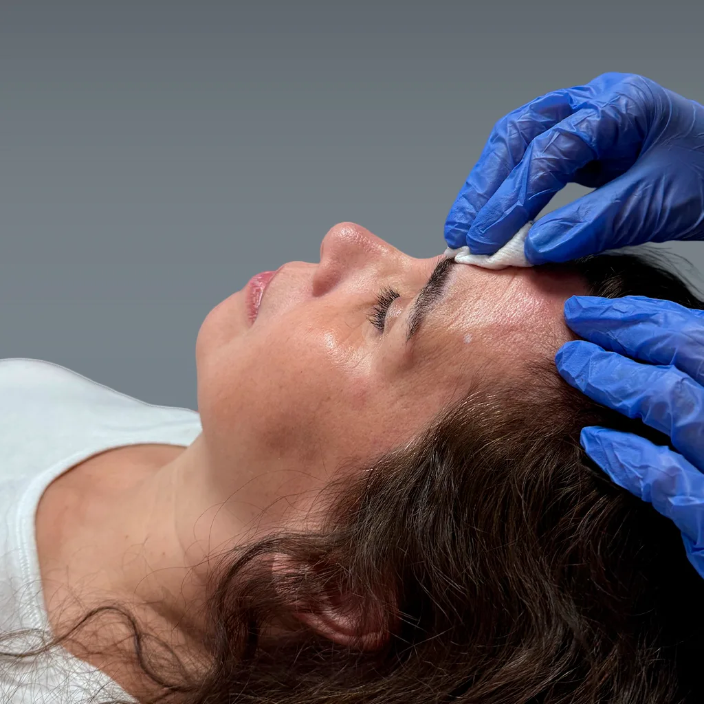 Botox en la cara: ¿Cuánto dura este tratamiento? 2 Botox y sus efectos
