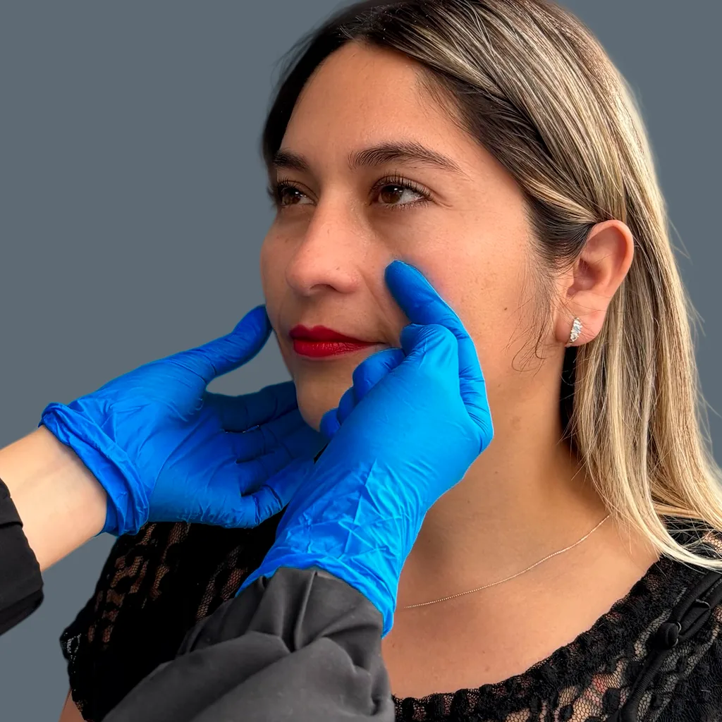 acido hialuronico en la cara