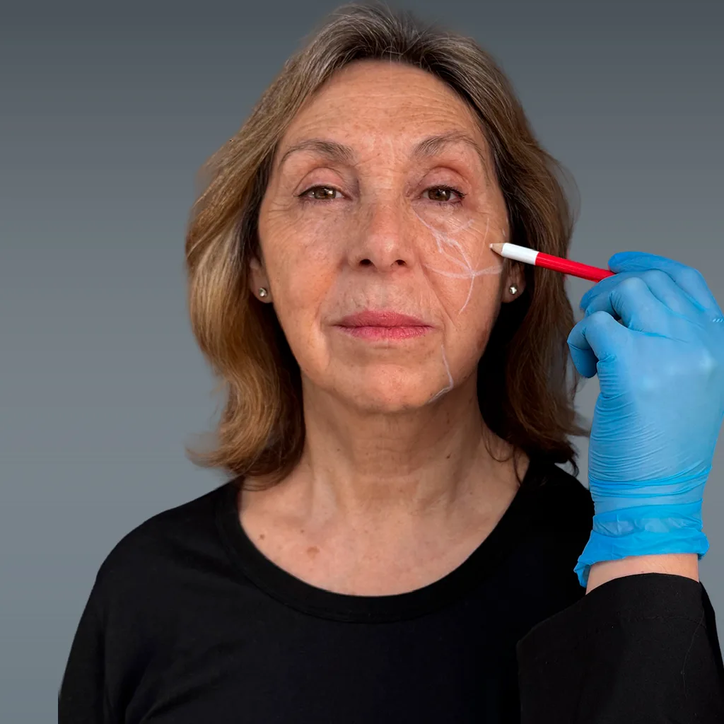 Los mejores laboratorios del mundo: Galderma y Allergan 2 Los mejores laboratorios del mundo: Galderma y Allergan