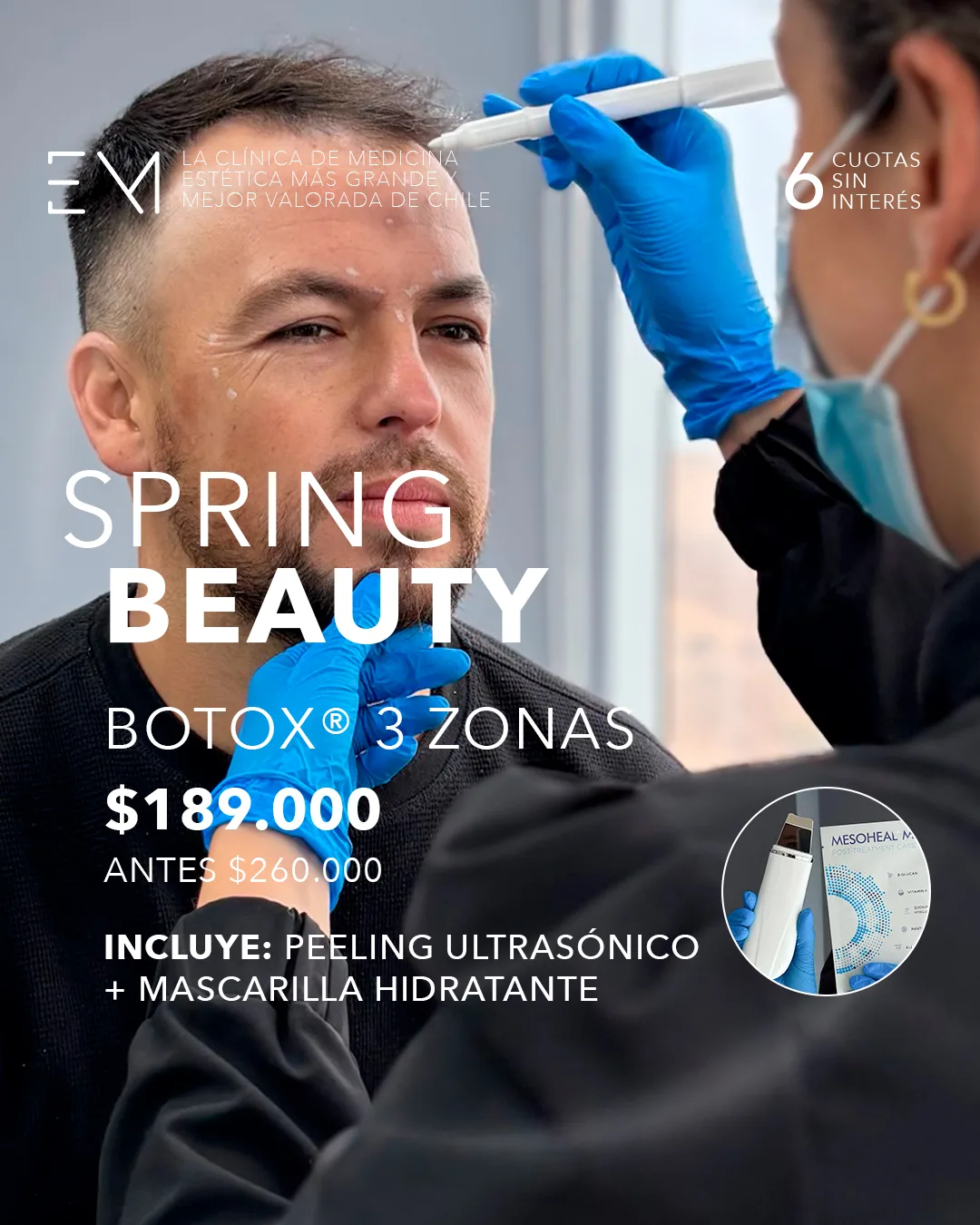 Toxina 3 zonas + Peeling ultras&oacute;nico + M&aacute;scara